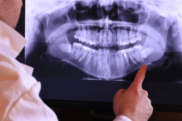 Best Broken or Cracked Tooth Emergency Dentist in Ida Grove, IA