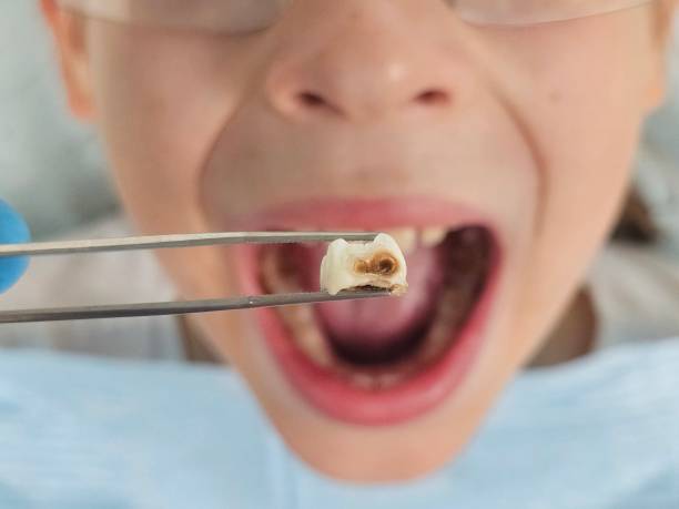 Best Emergency Dental Services for Seniors in Ida Grove, IA