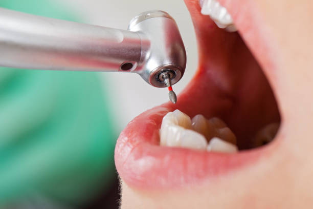 Best Emergency Dentist for Knocked-Out Tooth in Ida Grove, IA